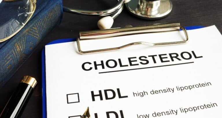 Hoe vaak moet ik mijn cholesterol laten controleren?